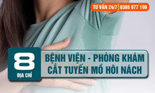 Top 8 địa chỉ bệnh viện chữa, cắt tuyến mồ hôi nách uy tín