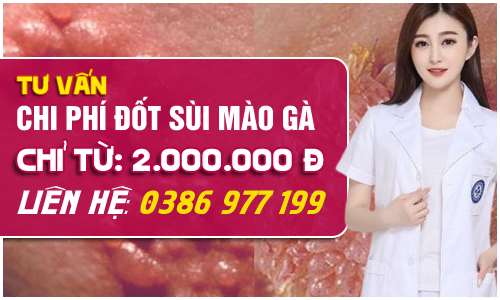 Bảng giá chi phí đốt sùi mào gà chi tiết từng phương pháp