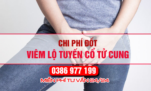 Chi phí đốt viêm lộ tuyến cổ tử cung hết bao nhiêu tiền