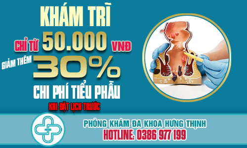 Chi phí khám bệnh trĩ chỉ 50 000 vnđ