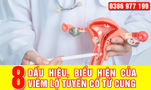 Top 8 dấu hiệu, biểu hiện của viêm lộ tuyến cổ tử cung