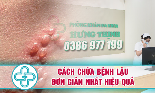 Cách chữa bệnh lậu đơn giản nhất mà vẫn hiệu quả